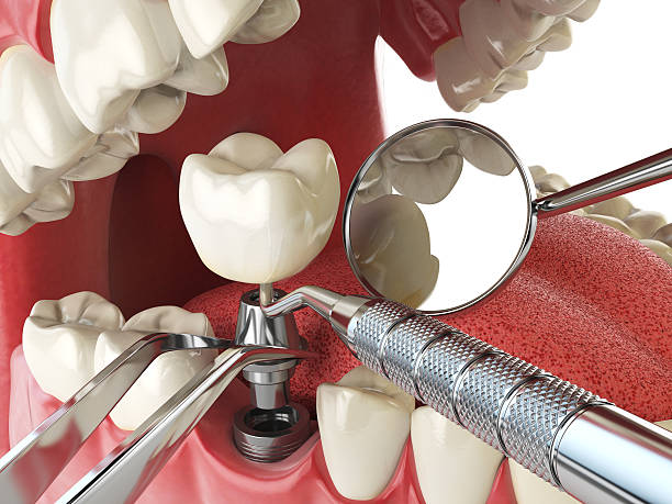 Best Emergency Treatment for Oral Infections in Lmyra, PA
