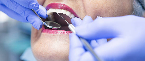 Best Dental Abscess Treatment in Lmyra, PA
